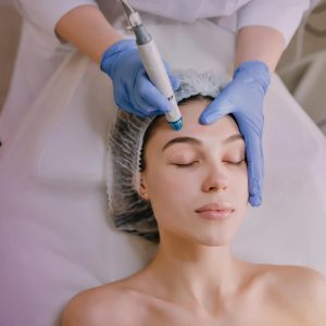 Dermapen facial