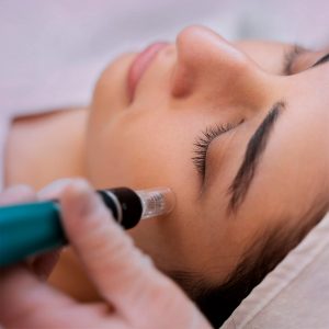 Tratamiento hidrofacial con oxigeno