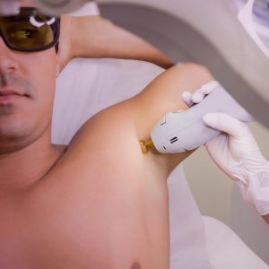 Tratamiento IPL Foto depilación