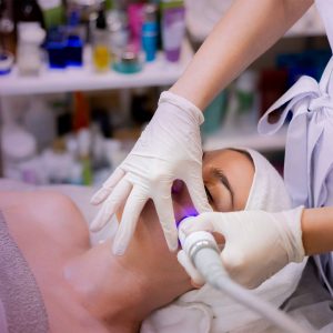 Tratamiento IPL fotorejuvenecimiento facial